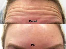 pobrane (2)